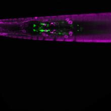 Microscopy image of c. elegans.