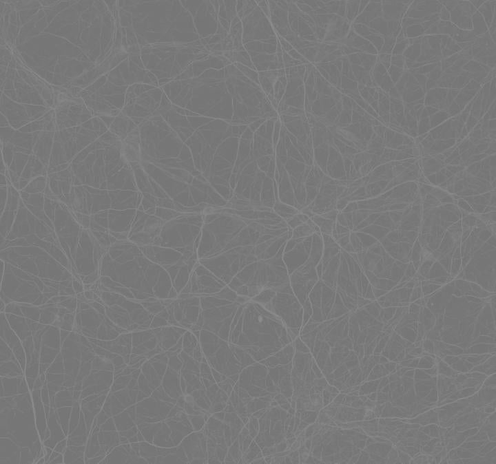 Neurofilament stain in neuronal culture