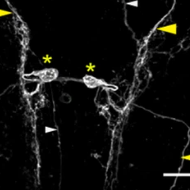 drosophila neurons