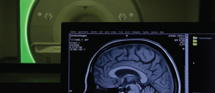 lewis_center Lewis Center for Neuroimaging